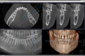 Cone Beam X-rays